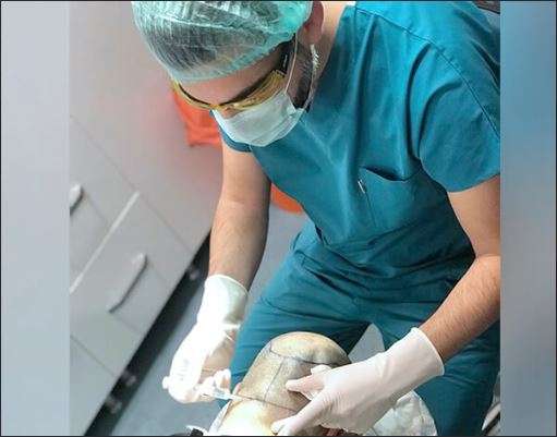 مركز هيرميست لزراعة الشعر تركيا